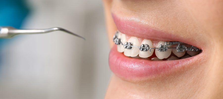 implantes-dentales-scaled